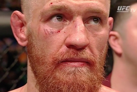 Checkout Conor McGregor Right After Loss To Nick Diaz